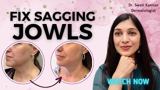 Sagging Jowls Dermatologists Secrets for a Tight Jawline Without Surgery [upl. by Lekar]