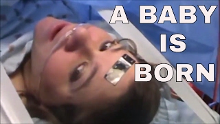 A BABY IS BORN   Gabriels Hydrocephalus Journey  Episode 2 [upl. by Verge478]