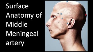 Surface Anatomy of Middle Meningeal Artery and Pterion anatomy [upl. by Rigdon742]