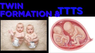 Twin formation  twin to twin transfusion syndrome  ttts [upl. by Neelia]