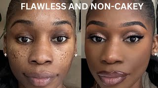 PITTED ACNE SCAR MAKEUP TUTORIAL STEP BY STEP ICEPICK SCARSBOXCAR SCARSCRATERS [upl. by Ayadahs]