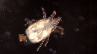 Histiostoma mite from substrate underneath an old oak 4K [upl. by Euqnimod]