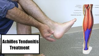 Achilles Tendonitis Treatment  Heel Pain Stretches and Exercises [upl. by Narcho]