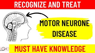 What is Motor Neuron Disease MND  All you need to know  Causes  Symptoms  Diagnosis Treatment [upl. by Htabmas787]