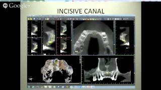 Mapping Vital Structures CT Machines and Scanning 1CE No Charge [upl. by Pollitt]