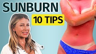 Top 10 Tips to Heal Fast from Sunburn [upl. by Lexine]