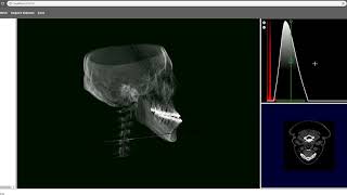 3D CT Visualization Web Demo volume rendering [upl. by Indnahc]