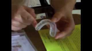 ProDental 3in1 Mouth Guard Review [upl. by Ebanreb]