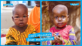 Luul’s recovery from severe malnutrition in Somalia  UNICEF [upl. by Arraek]