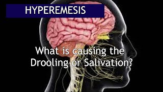 Hyperemesis What causes the Excessive Salivation  Antai Hospital [upl. by Lyrehc]