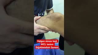 Valgus stress test for MCL injury positive test kneepain knee الامالمفاصل تاهيل [upl. by Rizas]