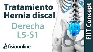 Tratamiento de la hernia discal L5 y S1 derecha o quinta lumbar y sacro [upl. by Burroughs]