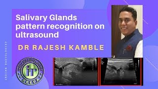 TMT Pattern Recognition in Salivary Gland Lesions by Dr Rajesh Kamble [upl. by Aikemaj153]