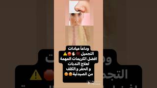 أفضل كريم للندبات العميقة  كريم لإزالة الندبات من الوجه  كريم للندبات و الحفر pigmanorm [upl. by Noellyn]