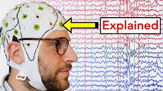 EEG Electroencephalogram Explained [upl. by Almeta959]