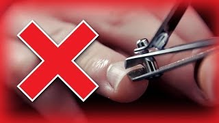 STOP Cutting Your Fingernails WRONG  How To Correctly Cut Nails In Good Shape [upl. by Lemcke615]