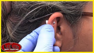 Crooked Piercing Caused By Piercing Bump [upl. by Lymann]