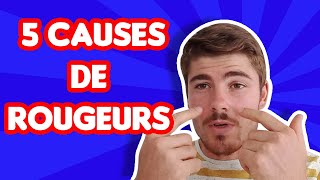 5 causes de rougeurs au visage [upl. by Gipsy]