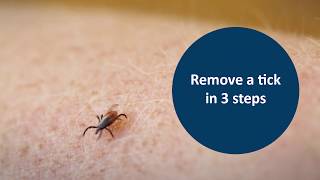 Remove a tick in 3 steps [upl. by Jovia]