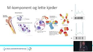 Hva er myelomatose og hvordan behandles det i Norge [upl. by Deyas]