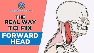 The REAL Way to Fix Forward Head  Headaches amp Neck Pain BEGONE [upl. by Halverson427]