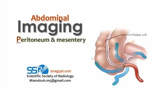 14 Imaging of peritonium and mesentery TEC Prof Mamdouh Mahfouz [upl. by Nihhi]