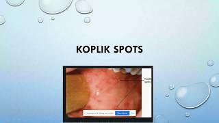 KOPLIK SPOTS MEASLES [upl. by Allisirp]