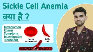 Sickle Cell Anemia in Hindi  Causes Symptoms and Treatment of Sickle Cell Anemia [upl. by Koslo]