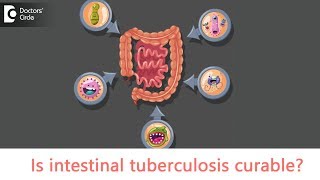 Intestinal tuberculosis  Causes Symptoms  Is intestinal TB contagious  Dr Rajasekhar M R [upl. by Nelda]