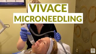 Vivace Microneedling With RF Rejuv Cosmetic Center NJ [upl. by Leora679]