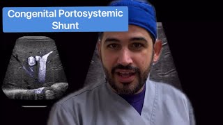 Congenital Portosystemic Shunt [upl. by Debora]