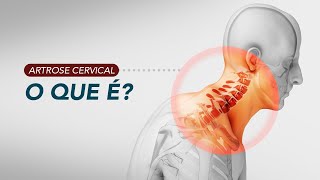 Artrose da coluna cervical  O que é e como fazemos o diagnóstico [upl. by Lotsyrk827]