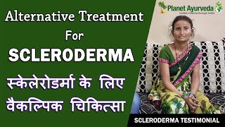 Alternative Treatment For Scleroderma  Real Testimonial [upl. by Anavlys]