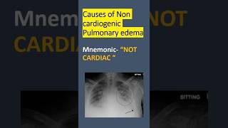 NON CARDIOGENIC CAUSES OF PULMONARY EDEMA [upl. by Hutchison]