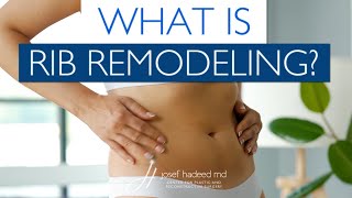 What is Rib Remodeling Surgery [upl. by Fevre]