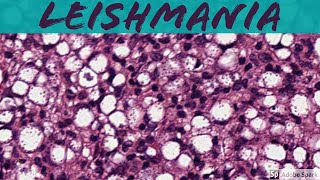 Leishmaniasis 5Minute Pathology Pearls [upl. by Llener]