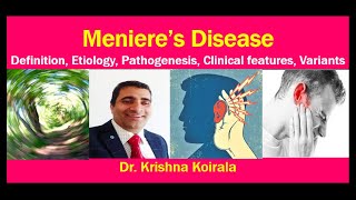 Menieres disease Definition Etiopathogesis Clinical features Variants  Dr Krishna Koirala [upl. by Eelhsa]