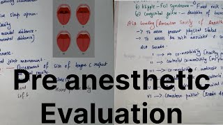 Preanesthetic Evaluation  Anesthesia dene ke Pehle kya kya checkup karte hAllrounderdoctorfalit [upl. by Ynotna]