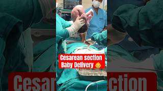 Cesarean section baby deliverynewbornviral [upl. by Ybbob]