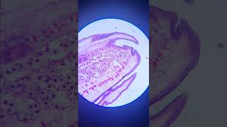 Worm 🧐😵 under MicroScope shorts microscope experiment [upl. by Torrell202]