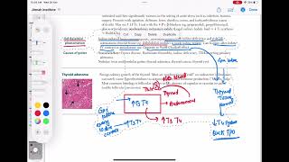 causes of goiter endocrinology 47  First Aid USMLE Step 1 in UrduHindi [upl. by Eeliram]