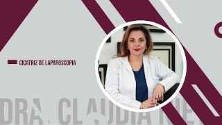 CICATRIZ DE LAPAROSCOPIA  DRA CLAUDIA NIETO [upl. by Mame]