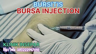 BURSITIS  BURSA INJECTION  ruralhealthcare syarhan [upl. by Ettebab]