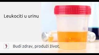 Leukociti u urinu mokraći [upl. by Ruggiero]