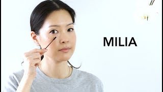 Milia  How to Treat amp Prevent  Best Eye Products [upl. by Ariom]