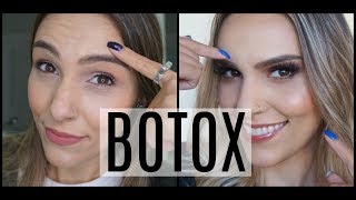 COLOQUEI BOTOX OLHA COMO FICOU [upl. by Donall817]