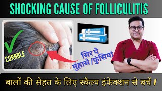 Shocking Causes Of Folliculitis You Never Knew  Cause Symptoms amp Treatment  follicullitis [upl. by Yblek]