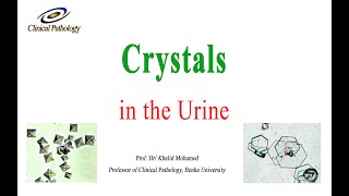 Urine analysis Part 4 Crystals in urine sediment [upl. by Schwitzer]