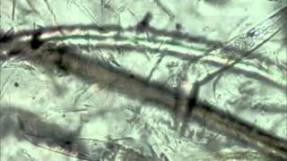 Canine Demodex Mites [upl. by Kolosick474]