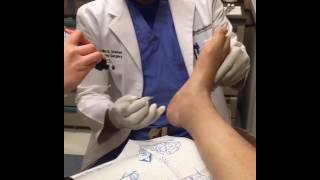 Dr Shaheed  Plantar Fasciitis Injections [upl. by Bullen590]